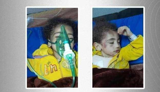 50% من خلايا دماغها توقفت.. طفلة تدخل بغيبوبة بعد تعرضها لضرب من زوجة أبيها في دمشق